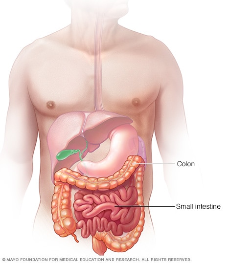 L'intestino tenue è un tubo cavo che va dallo stomaco all'intestino crasso (colon).